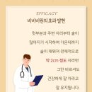 비비비원 이미지