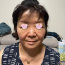 셀렉트피부과의원 | 화상 &amp; 보톡스. 필러 (내 치료 ❌ 내 시술 ❌ 엄마 시술)