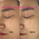 4192 | 창원 어반브릭스 유일한에스테틱 창원여드름관리 후기