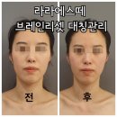 라라에스떼 이미지