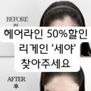 대구헤어라인문신 후기, 자연스럽게 채워졌어요