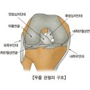 슬관절 내부장애 (Internal derangement of knee,IDK) 이미지