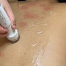 창원 피부관리, 어반브릭스 &#39;유일한 에스테틱&#39; 지우개 필링 1회 관리 후기
