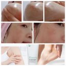 각질제거제 아마란스 보드레 필링젤 찐사용후기