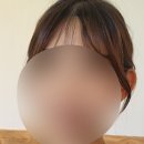 카라헤어샾 - 달서구 | 헤어라인 레이저 제모 시술 4회차 진행 후기