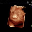 31140-8-23-25 | 임신 23~25주차 증상과 일상 ㅣ 태동변화,입체초음파,임당검사,h&amp;m베이비,유니클로 바디수트,산후도우미...