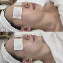 쥬니에스테틱 | 부천피부관리 쥬니에스테틱에서 웨딩케어 받고 온 후기