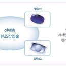 국제적으로 인정을 받은 청담/부산 밝은세상안과 이미지