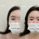 예뿐눈썹 이미지