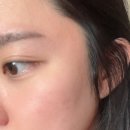 큐어시스 | 큐어시스 아크비타 잡티 세럼 후기 여드름흔적 관리에 순했던 비타민 세럼