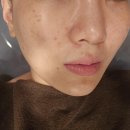 꼼꼼하고 유명한 영통피부관리 애띠애 VVS무결점관리 솔직후기