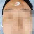 B5 | 피부과 재생크림 시카 벨더마 레이저 리페어크림 B5 후기