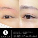 닷라인 | 분당아이라인문신 블랙닷 고른 5가지 이유