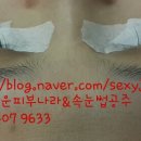 고운피부나라