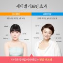 강남 리프팅잘하는병원 이미지