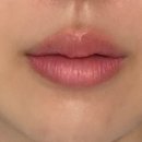 강남라렌의원 이미지