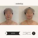 경락 | 창원 상남동 온다데이 | 비대칭 관리, 리프팅, 경락 내돈내산 찐 후기🪄·̩͙⋆