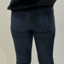 첨단기업로2L(2)-9 | 성남 지방분해주사효과 얼마나 있을까? 시술 전후 비교 후기 정리