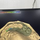 M치과기공소 이미지