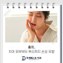 덕계베스트치과의원 네이버블로그