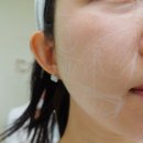울쎄라 프라임 후기 , 효과, 통증 정보 [30대 이중턱 리프팅]