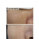 세종 반곡동 화이트 에스테틱♥ 여드름, 모공관리 후기❤️