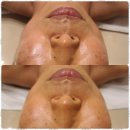 힐링 피부샵 이미지