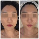 189.중앙역고가밑_1 | 운정 피부관리 라끄스킨 강추