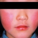 위례서울소아청소년과의원 이미지