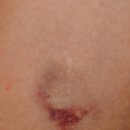 비타민한의원 이미지