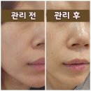 머리하는별 | 광명피부관리 확실한 비포 애프터 머리하는 별 솔직후기