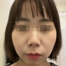 손길한의원 | 청담동한의원 얼굴비대칭 교정 내돈내산 솔직 후기 턱관절 안면비대칭