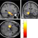 전주벨톤보청기 이미지