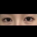 내추럴킴 | NDP내추럴더마프로젝트 리아킴 블랙헤드 클렌징밤 후기
