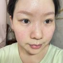 기미 주근깨 없애는법 시술 대신 고른 장희빈미안법