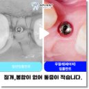 에이플란트치과의원 이미지