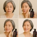 홍스피부이야기