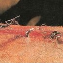 개미를 이용한 상처 봉합술 이미지