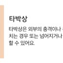 멍발머리 이미지