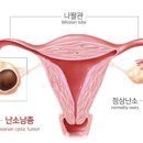 리본여성의원 네이버블로그