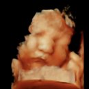 장스여성병원 | [34주] 임신기록 (장스여성병원 34주 정기검진 후기)