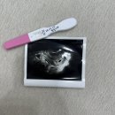 메디렌느산부인과의원 | ep01 | 4-5주차 | 병원 진료 | 뿌꿍이 존재를 확인하다 👶🏻(ft. 루트여성의원💜)