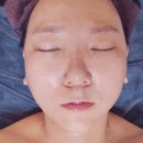 군산수송동피부관리 보금뷰티 올인원동안테라피 후기