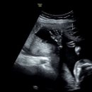 가연관악산부인과의원 이미지