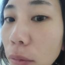 거제도 피부관리 토탈뷰티 핑크클럽 촉촉채움 머미케어 후기
