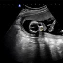 세인트여성의원 이미지