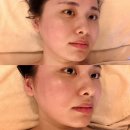 역삼 : 강남에스테틱 약손명가 역삼점에서 K-뷰티 연예인관리 받은 후기*원장님 한테 받은 썰
