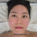 케이엠프라이빗 | 마곡윤곽관리 잘하는 손금원장님 케이엠 에스테틱 윤곽관리 후기