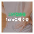생생병원 | 고관절충돌증후군 내시경수술 직원이 받은 후기! 부천 정형외과 생생병원