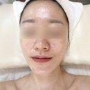[시흥/정왕동] 모공관리하러 정왕동 하영뷰티에서 아쿠아필 받은 후기